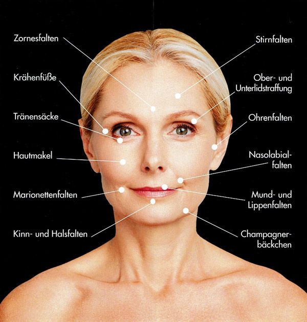 Cosmetic-Institut Heike Sachs Plasma Facelifting