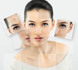 Cosmetic-Institut Heike Sachs Plasma Facelift Behandlung