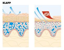 Cosmetic-Institut Heike Sachs Micro-Needling